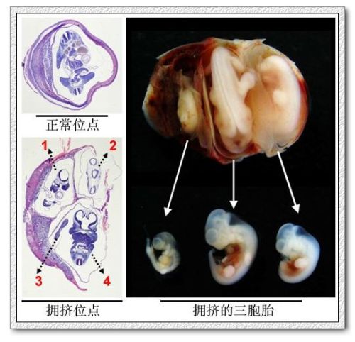 小鼠妊娠第12天组织切片比较正常植入位点和拥挤的植入位点
